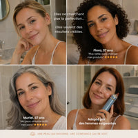 Résultats avant-après visage des clientes utilisant l'appareil anti-âge ORA LIFT PRO
