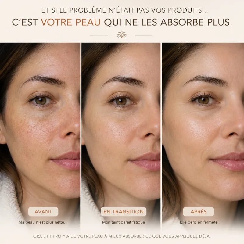 Évolution d'un visage en 3 étapes : Avant, En transition et Après l'utilisation de l'appareil ORA LIFT PRO. Le visuel montre une nette amélioration de l'éclat, de l'uniformité et de la fermeté de la peau avec le texte explicatif 'C'est votre peau qui ne les absorbe plus'.