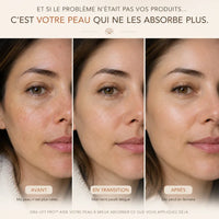 Évolution d'un visage en 3 étapes : Avant, En transition et Après l'utilisation de l'appareil ORA LIFT PRO. Le visuel montre une nette amélioration de l'éclat, de l'uniformité et de la fermeté de la peau avec le texte explicatif 'C'est votre peau qui ne les absorbe plus'.