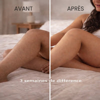 Comparatif avant après sur des jambes après 3 semaines d'utilisation de l'épilateur à lumière pulsée IPL LUNA de TRYOVIA, montrant une réduction visible des poils et une peau plus lisse.